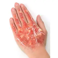 Horrorhaut Flüssiglatex Effekt Make-up