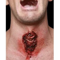 Trakeotomie